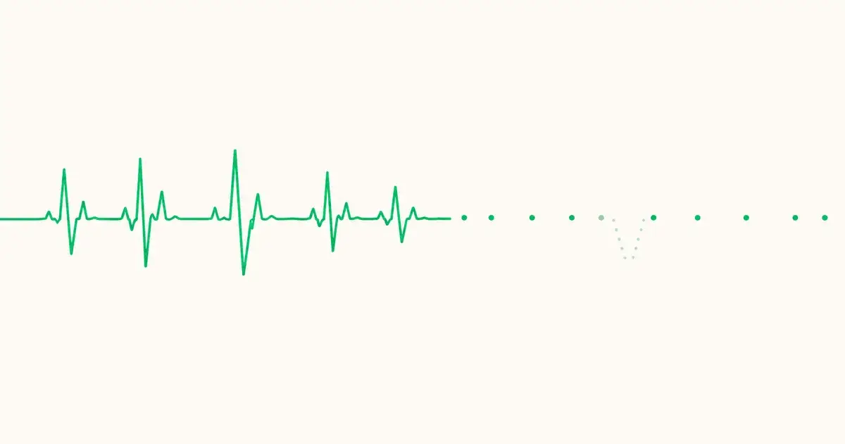 Illustration of a green heartbeat line, dense and continuous on the left, degrading into widely spaced dots on the right with a faint dropped notch hidden inside one of the gaps.